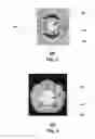 Fig. 03 - Method and apparatus for mounting network devices