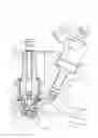 Fig. 09 - Spark plug with shuttle electrode