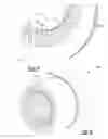 Fig. 07 - System and method for stator slot encapsulation using injected polymer