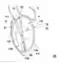 Fig. 01 - EARPHONE