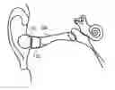 Fig. 01 - Earphone