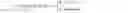 Fig. 04 - Multiplexing control information in a physical uplink data channel