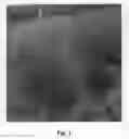 Fig. 02 - Festuca grass named 'Freedom Fire Vida'