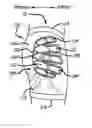 Fig. 01 - HIP PROTECTORS