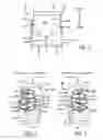 Fig. 02 - HIP PROTECTORS