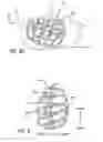 Fig. 06 - HIP PROTECTORS