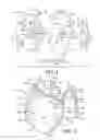 Fig. 02 - Protective device for use with a glove