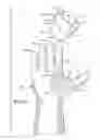 Fig. 04 - Protective device for use with a glove