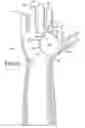 Fig. 05 - Protective device for use with a glove