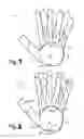 Fig. 02 - A Protective Glove