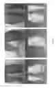 Fig. 03 - Methods of generating compression garment measurement information for a patient body part and fitting pre-fabricated compression garments thereto