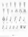 Fig. 04 - Methods of generating compression garment measurement information for a patient body part and fitting pre-fabricated compression garments thereto