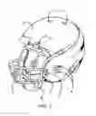Fig. 04 - Helmet and related methods