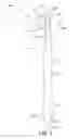 Fig. 02 - Fluid supply apparatus and personal care implement containing the same