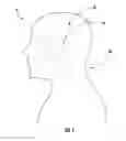 Fig. 02 - HEAD ACCESSORY FOR PROMOTING BACK SLEEPING