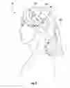 Fig. 04 - HEAD ACCESSORY FOR PROMOTING BACK SLEEPING