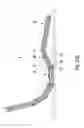 Fig. 33 - Electric motor driven adjustable mattress