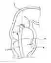 Fig. 01 - ENDOSCOPE