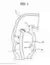 Fig. 02 - ENDOSCOPE