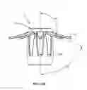 Fig. 41 - FITTING FOR A MEDICAL SCOPING DEVICE