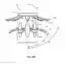 Fig. 50 - FITTING FOR A MEDICAL SCOPING DEVICE