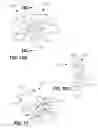 Fig. 16 - Medical Devices, Systems, and Methods for the Visualization and Treatment of Bodily Passages