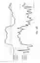 Fig. 04 - Brain activity estimation device