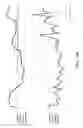 Fig. 08 - Brain activity estimation device