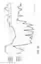 Fig. 10 - Brain activity estimation device