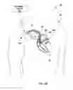Fig. 03 - MEASURING CARDIOVASCULAR PRESSURE BASED ON PATIENT STATE