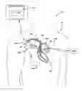 Fig. 01 - Exercise triggered cardiovascular pressure measurement