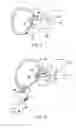 Fig. 03 - DEVICE AND METHOD FOR MEASURING PRESSURE IN A PATIENT'S HEART