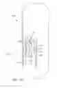 Fig. 83 - INGESTIBLE DEVICE AND ASSOCIATED METHODS