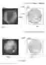Fig. 67 - Ingestible Device and Associated Methods