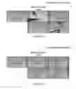 Fig. 62 - Ingestible device and associated methods