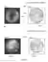 Fig. 67 - Ingestible device and associated methods