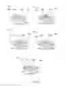 Fig. 77 - Ingestible device and associated methods