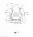 Fig. 02 - Electrode falloff detection