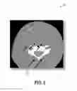 Fig. 08 - Collimator structure for an imaging system