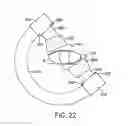 Fig. 22 - Fluoroscopy operator protection device
