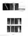 Fig. 09 - SYSTEM, METHOD, COMPUTER-ACCESSIBLE MEDIUM AND APPARATUS FOR FAST RADIOACTIVE SEED LOCALIZATION IN INTRAOPERATIVE CONE BEAM CT FOR LOW-DOSE-RATE PROSTATE BRACHYTHERAPY