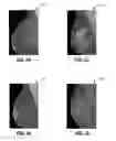 Fig. 02 - Methods and systems for determining breast density