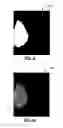 Fig. 06 - Methods and systems for determining breast density
