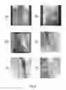 Fig. 03 - Image registration