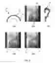 Fig. 05 - Image registration