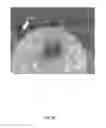 Fig. 07 - Intervolume lesion detection and image preparation