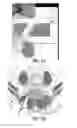 Fig. 40 - Device and System for Placing Securing Device Within Bone