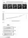 Fig. 13 - Adaptive medical image transmission device and method