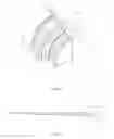Fig. 11 - Prostate biopsy needle