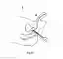 Fig. 16 - Prostate biopsy needle